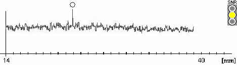 Axial Length Measurement