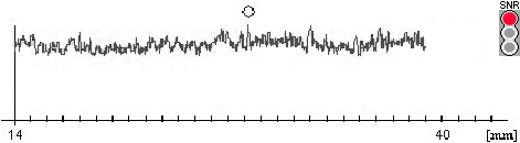 Axial Length Measurement