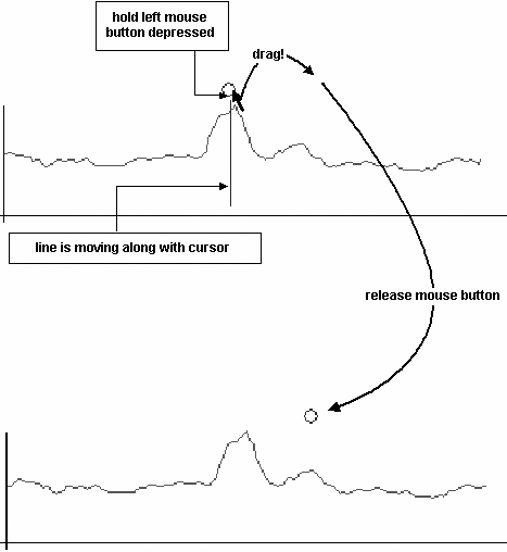 IOL Master Axial Length Measurements