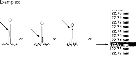 IOLMaster Axial Length Measurements