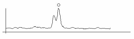 IOLMaster Axial Length Measurements