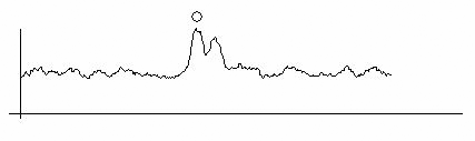 IOLMaster Axial Length Measurements