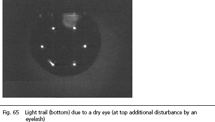 IOLMaster KERATOMETER software