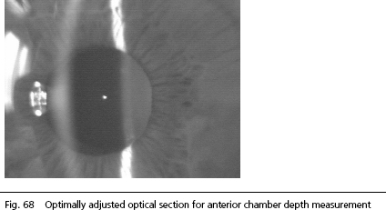 IOLMaster Anterior Chambe Depth