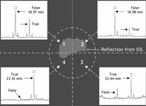IOL Master Pseudophakic false images